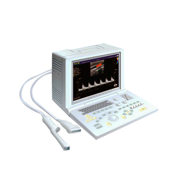 SonoScape SSI-1000 Portable Ultrason