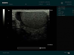 Edan Dus 60 Digital Diagnostic Ultrason